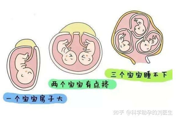 新生儿必买13清单
